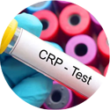 c reactive protein test