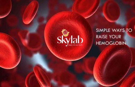 Simple ways to raise your hemoglobin Skylab clinical laboratory in Trivandrum